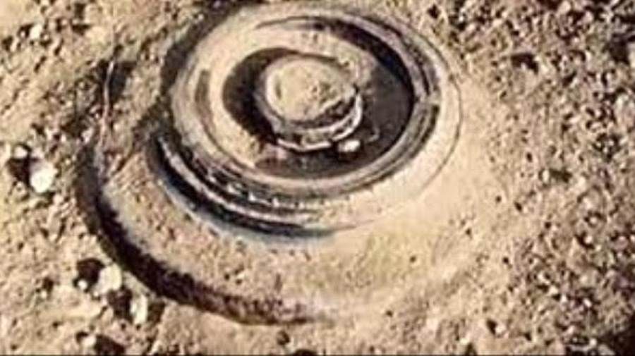 إصابة مواطن بانفجار لغم حوثي في الخوخة