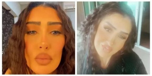 فنانات تشوهت ملامحهن بسبب الفيلر والبوتوكس واصلحن مرعبات . الأسماء ستصدمك!