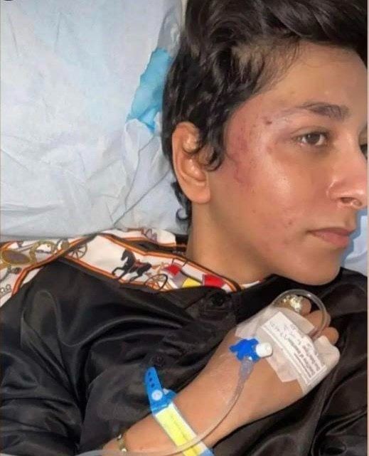 بظهور جديد مثير للجدل.. كدمات وتشوهات في جه ريان جيلر