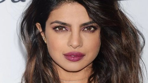 تشوه كبير في وجه الجميلة بريانكا شوبرا يحزن قلوب جمهورها.. لن تصدق كيف أصبحت وما حدث!