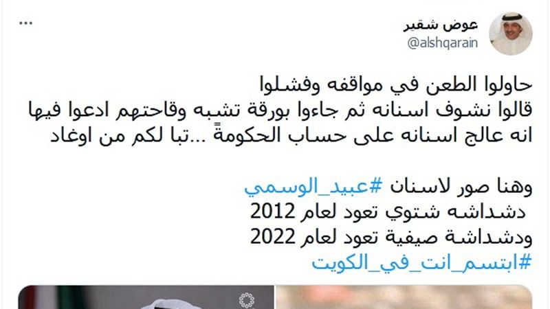 تجميل أسنان النائب عبيد الوسمي يثير جدلًا واسعًا في الكويت