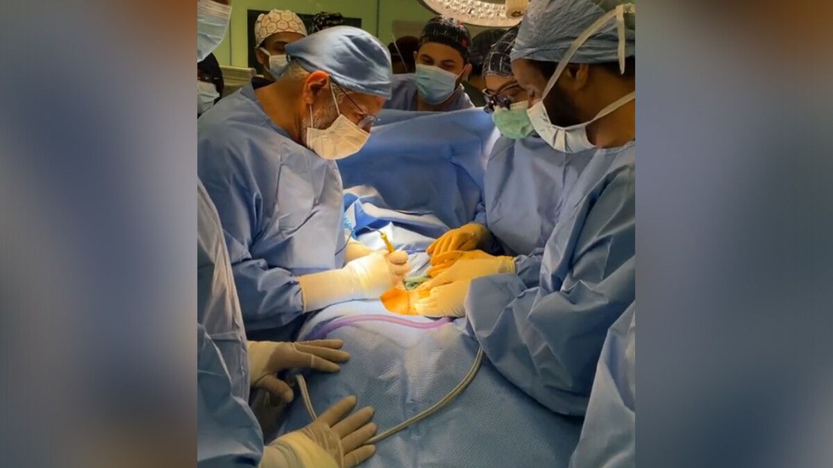 السعودية.. نجاح عملية فصل التوأمين اليمنيين "مودة ورحمة"