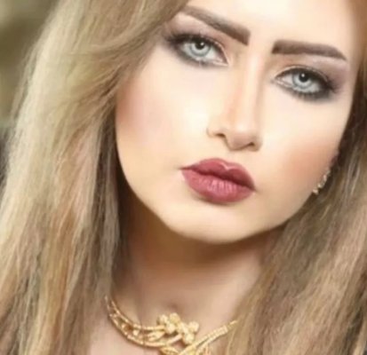 قبل البوتكس والفيلر.. لن تصدقوا أن هذه مي العيدان بشعة والجمهور يٌعلق: معقولة عمليات التجميل تغير كده)صورة