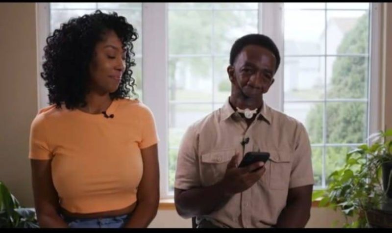 امرأة أمريكية تتزوج رجلا فقد نصف وجهه وتكشف سبب ارتباطها به ! (شاهد فيديو)