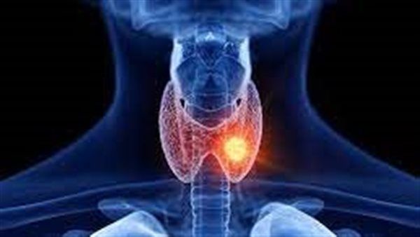 أحذر.. مواد سامة للغدة الدرقية
