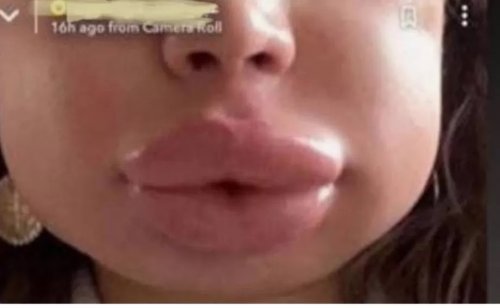 فنانة مصرية اشتهرت بجمالها تصدم جمهورها بتشوه شفتيها ووجهها.. لن تصدّق من هي وما حدث لها.... صورة