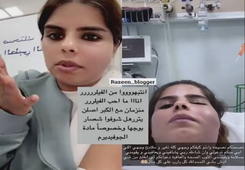 بلوقر كويتية تصدم متابعيها بمقطع فيديو يكشف إصابة وجهها بورم بعد حقنه بالبوتكس..(شاهد)