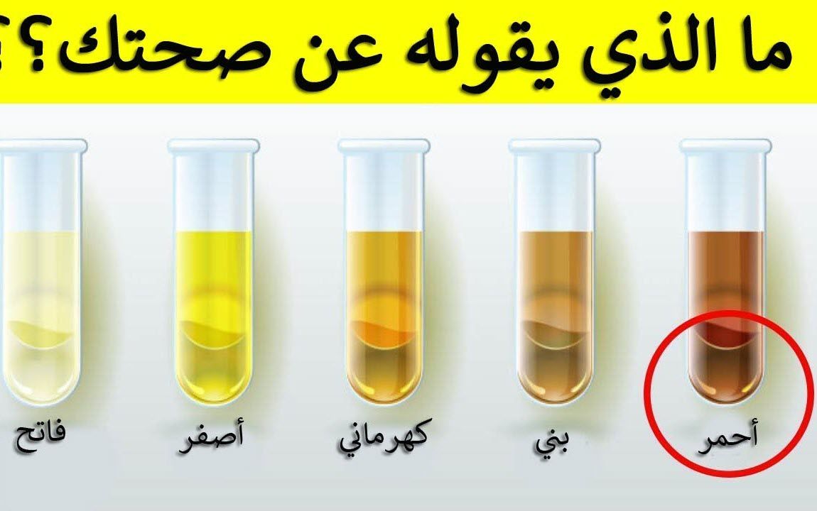 لون البول يكشف حالتك الصحية.. وهذا اللون خطير احذر منه!
