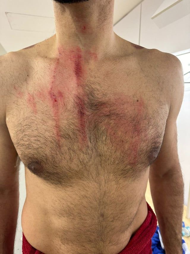 عمر السومة يتعرض لإصابة قوية بعد تدخل عنيف من مدافع الغرافة (فيديو)