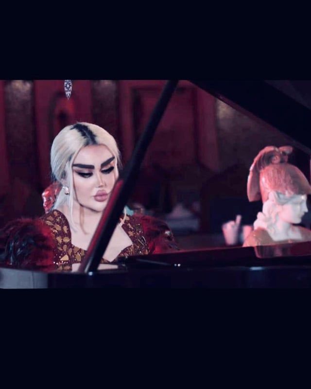 بسبب جراحات التجميل.. إعلامية عراقية تتصدر الصحف العالمية (صور)