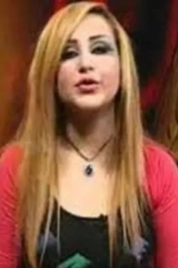 بسبب جراحات التجميل.. إعلامية عراقية تتصدر الصحف العالمية (صور)