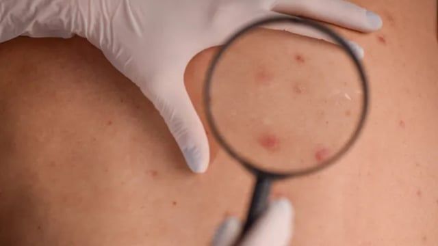 بشرتك أداة تشخيصية فعالة لصحتك