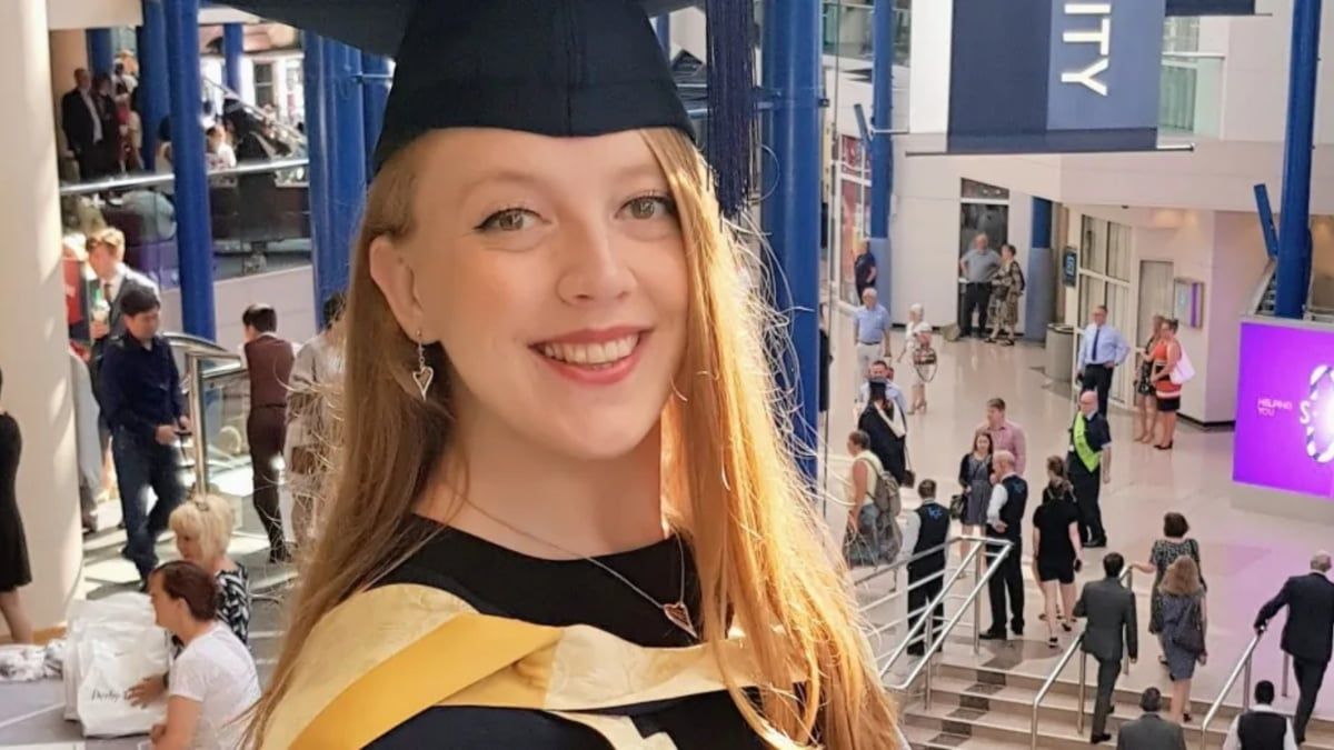 متلازمة نادرة تحرم شابة من تناول الطعام (صور)