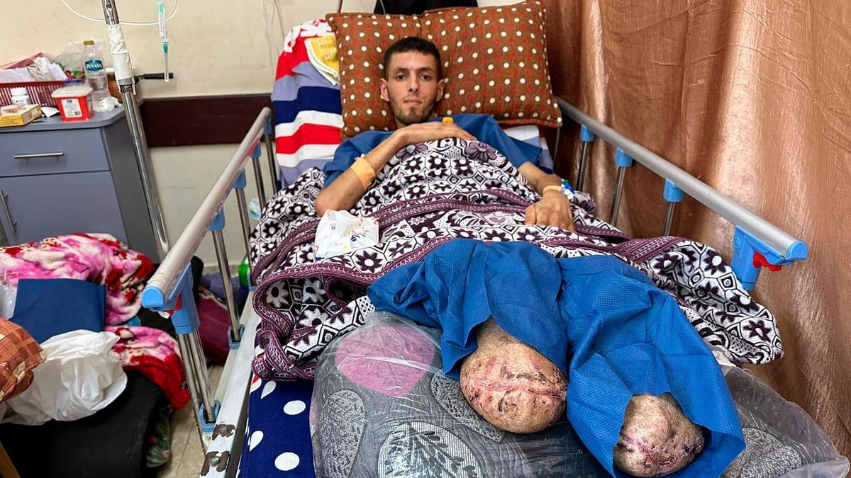 "الموت البطيء" يطارد فلسطينياً بُترت قدماه وتعفنت أمعاؤه (صور)