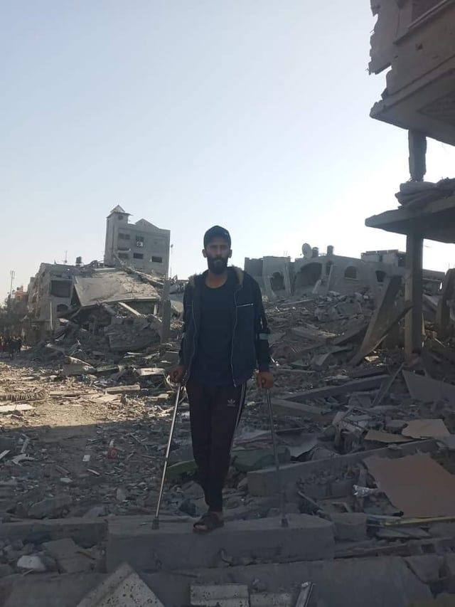 غادر شمال غزة بقدم واحدة.. أحمد أبو شرخ يروي مأساته مع النزوح (صور)