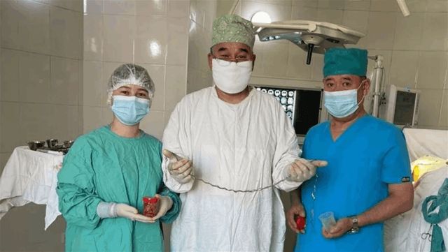 كادت أن تقتلها.. اكتشاف خصلة شعر طويلة في دماغ طفلة (صور)