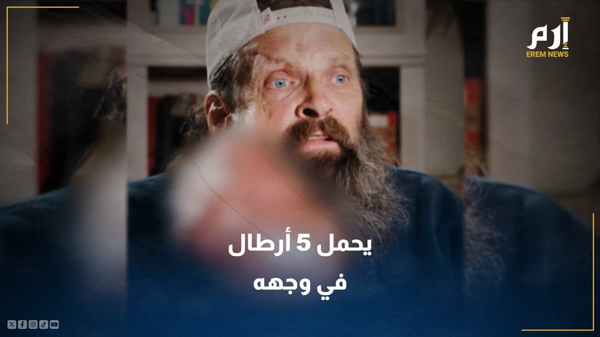 يحمل 5 أرطال في وجهه.. إهمال يقود صاحبه لفاجعة