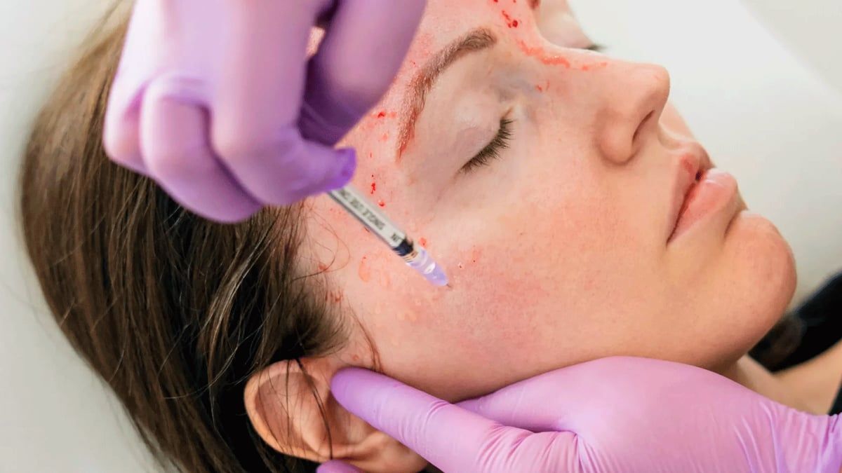 أمريكا.. مخاوف من دور التجميل في نقل الإيدز داخل منتجع صحي