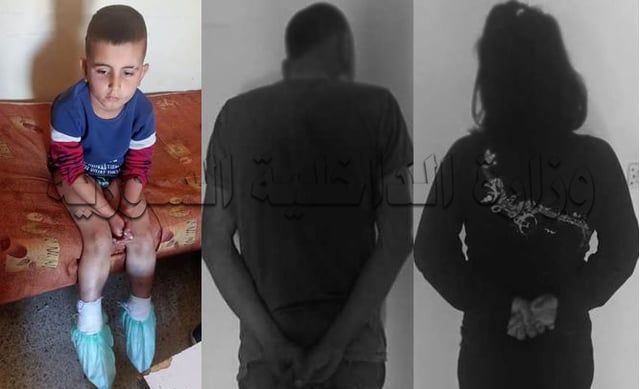 حرقا قدميه بـ"الفحم".. القبض على سوري وزوجته لتعذيبهما طفله