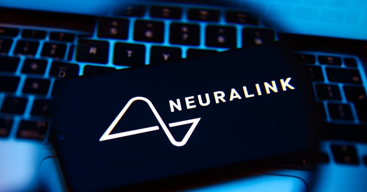 بعد زرعها في دماغ مريض.. شريحة إيلون ماسك تواجه مشكلة