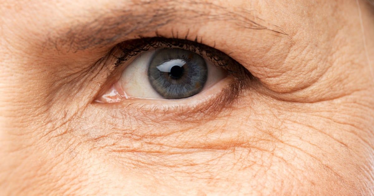 هكذا تظهر تجاعيد البشرة مع تقدم السن