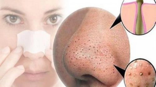 شاهد .. 10 دقائق فقط لتحقيق بشرة خالية من الرؤوس السوداء! تعرف على الطريقة السهلة والبسيطة