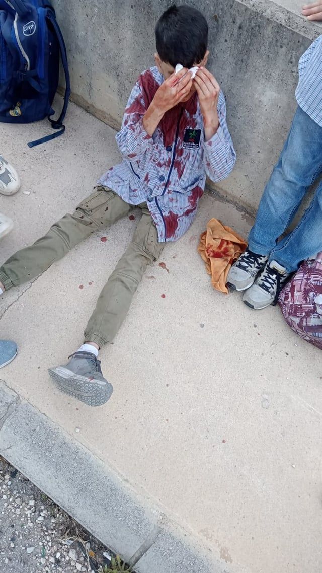 مقتل سائق وإصابة 3 طلاب بهجوم إسرائيلي جنوبي لبنان (صور)