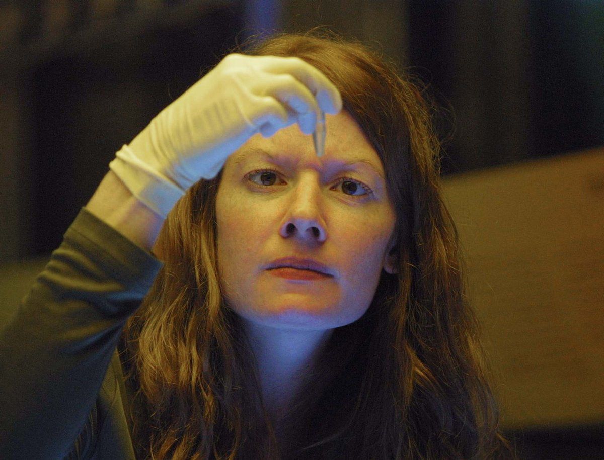 فحص"اللعاب" الأكثر دقة بكشف سرطان البروستاتا المبكر