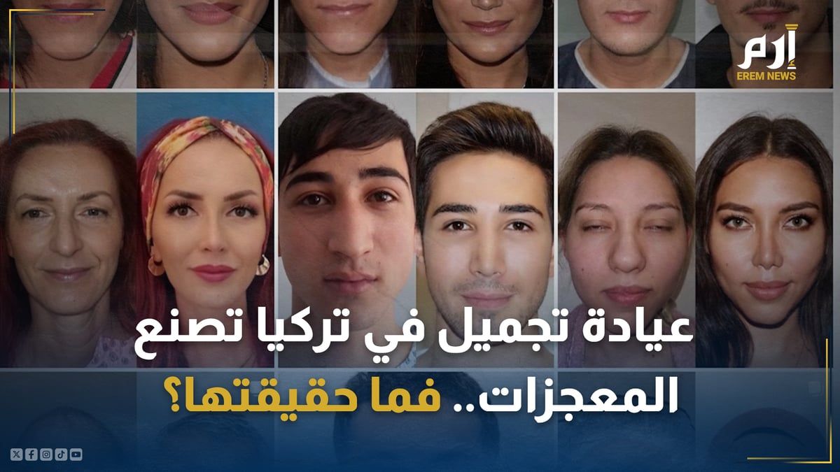 عيادة تجميل في تركيا تصنع المعجزات.. فما حقيقتها؟