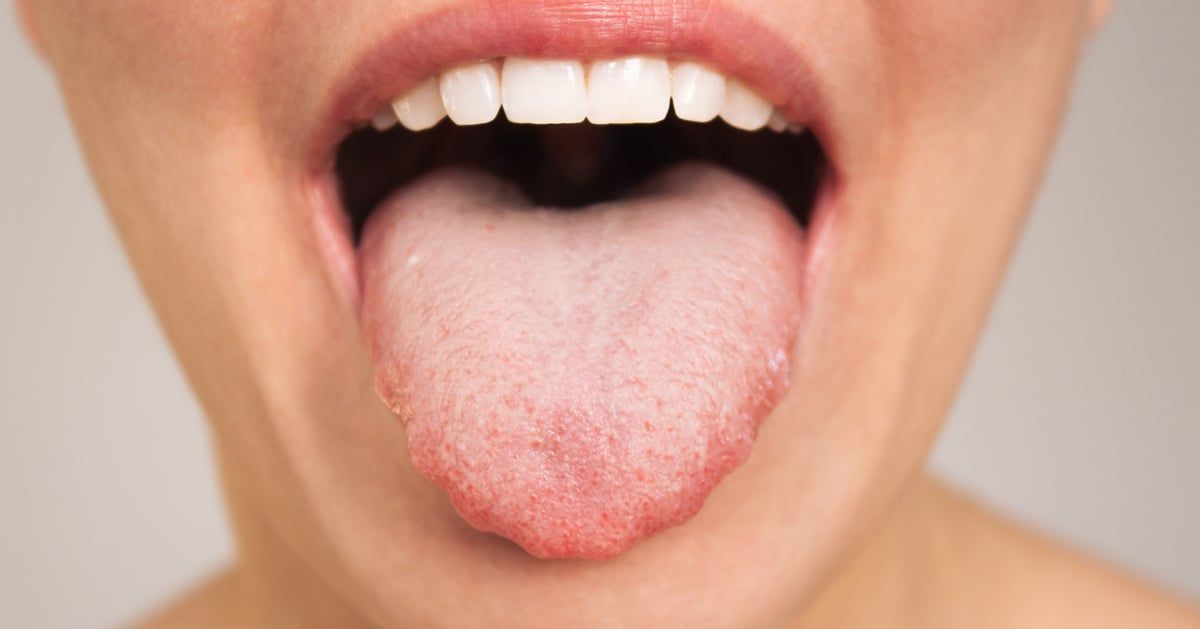 عارض "غريب" يظهر على اللسان يحذرك من القهوة (فيديو)