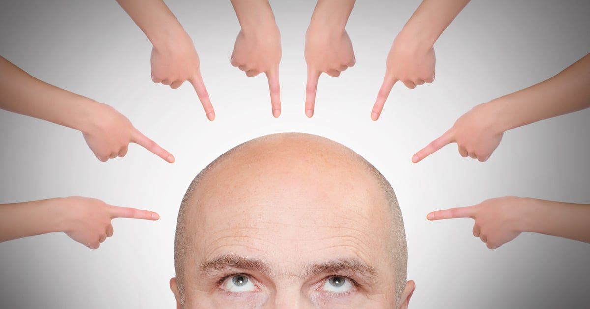 أغرب طلاق.. بعد يومين من الزواج اكتشفت أنه أصلع