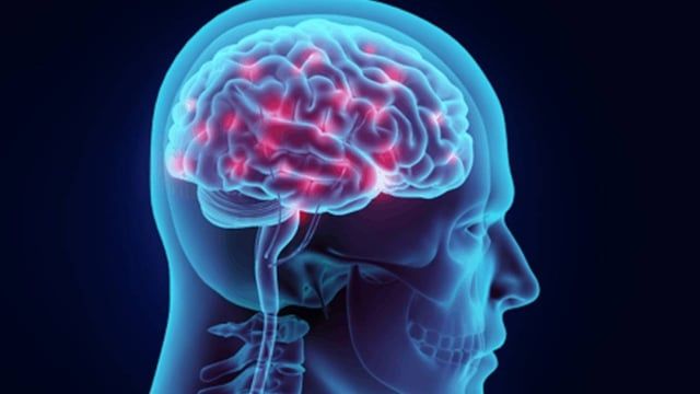 هذا ما يسببه قلة النوم على تكوين ذاكرتك والاحتفاظ بها