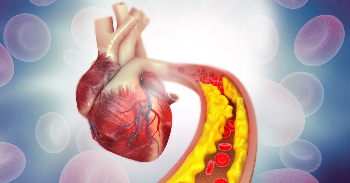 3 علامات على عينيك قد تدل على ارتفاع الكوليسترول (صور)