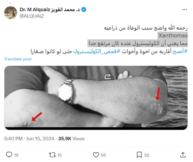 طبيب يكشف سبب وفاة كابتن الطائرة المصري على متن الرحلة (صورة)