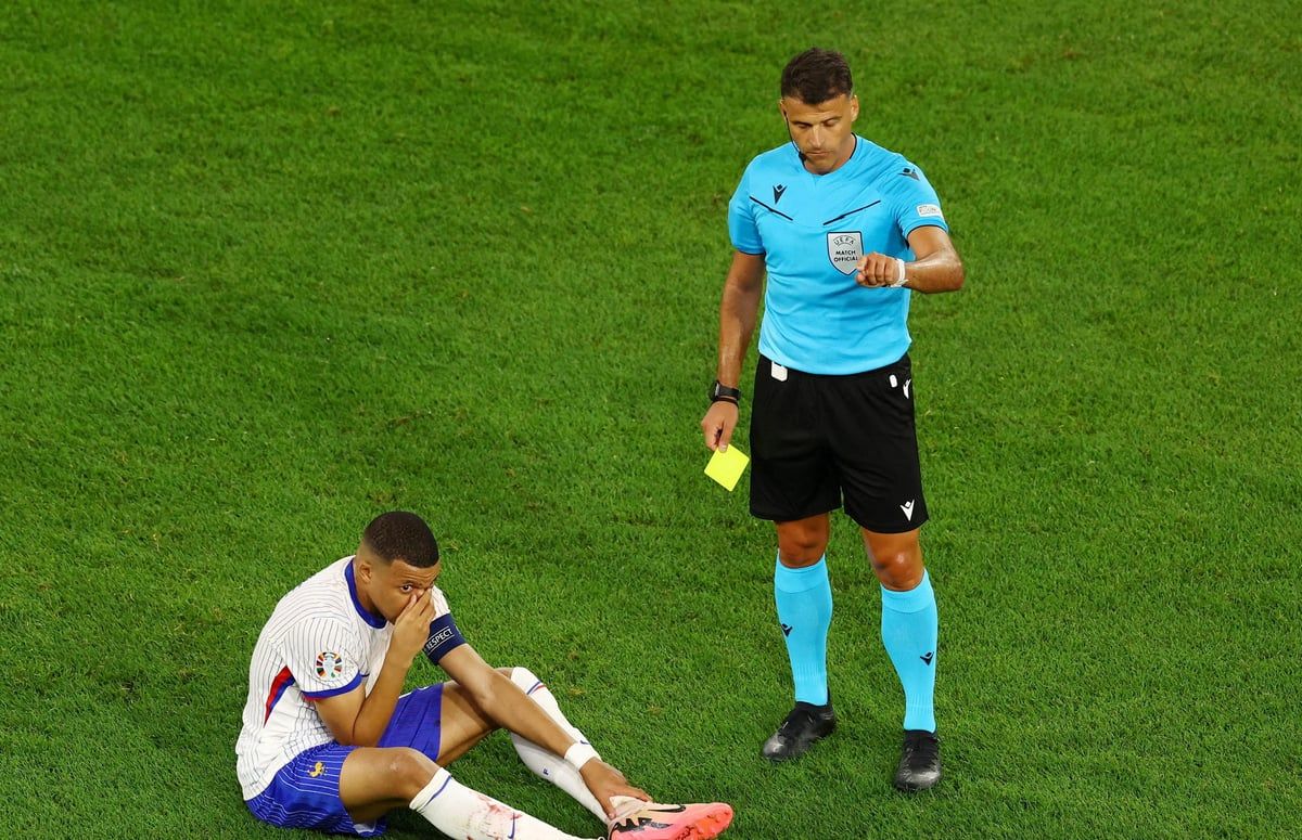 أول ظهور لكيليان مبابي بواقي الأنف (فيديو)