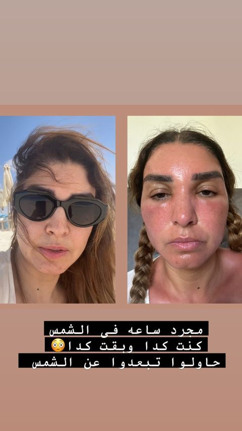 ساعة تحت أشعة الشمس تحوّل روجينا إلى امرأة أخرى (صورة)