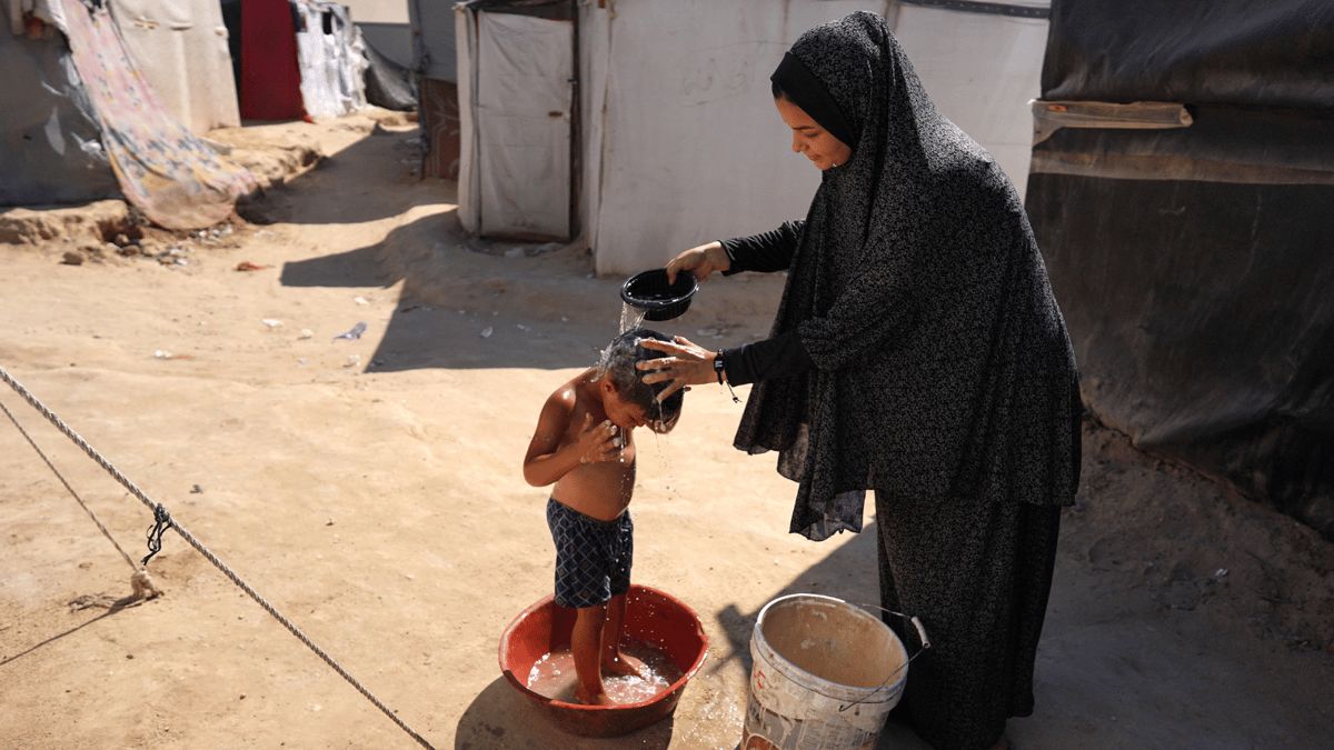 أمراض جلدية وأوبئة قاتلة.. مصير محفوف بالمخاطر للغزيين في مخيمات النزوح
