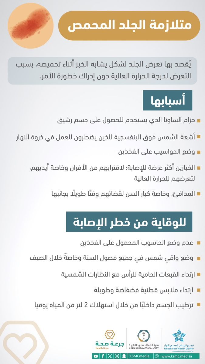 مدينة الملك سعود الطبية تصدر تحذيراً بخصوص الجلد المحمص وهذه العادة تسبب بظهوره - موقع الخليج الان