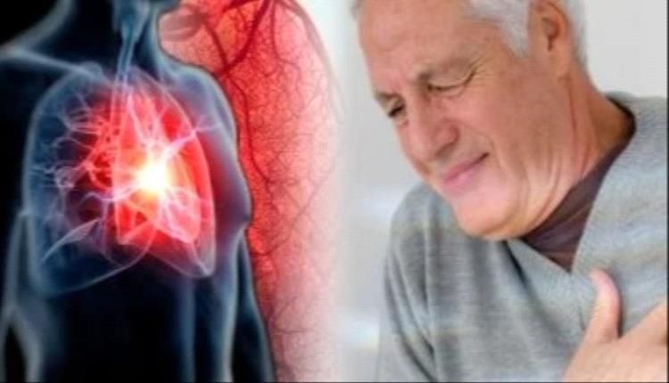 انسداد الشريان التاجي.. تعرف على العلامات التحذيرية المبكرة