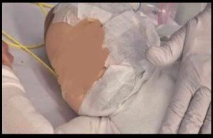 تفاصيل جريمة مرعبة.. توجّه نحو عائلة وسكب قهوة ساخنة على وجه رضيع (صور)