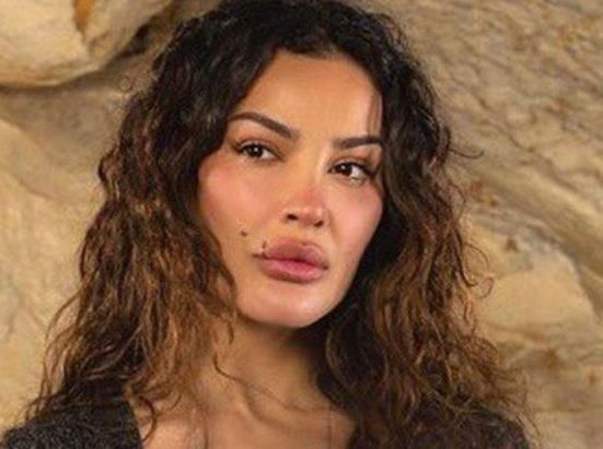 بالصورة… نادين نجيم: “هيك عملوا فينا”