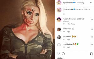 ميريام كلينك تطل بوجه مشوّه… وهذا ما كتبته عن لبنان (صورة)