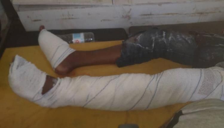 إصابة طفل بجروح بالغة إثر انفجار لغم من مخلفات الحوثي غرب حيس