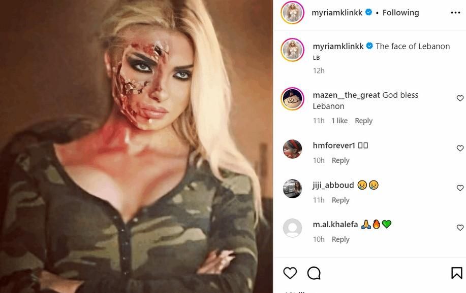 بالصورة: أطلت بوجه مشوّه.. هذا ما حصل مع ميريام كلينك