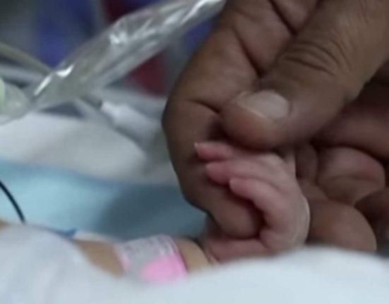 آثار الحرب على الحوامل… طبيب يتحدث عن موقف تعرض له طبيب نسائي مع مريضة (فيديو)