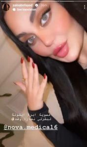 أطلت بشفاه منتفخة.. ابنة هيفا وهبي تكشف عن عمليات التجميل التي قامت بها (صور)