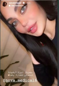 أطلت بشفاه منتفخة.. ابنة هيفا وهبي تكشف عن عمليات التجميل التي قامت بها (صور)