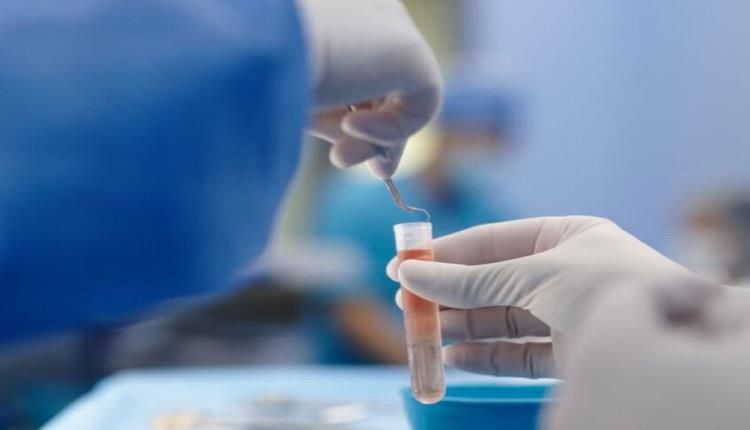 فريق طبي بالإمارات ينجح في اجراء عملية جراحية نادرة...تفاصيل