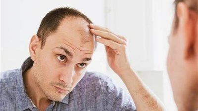 وداعًا لتساقط الشعر.. علاج واعد للصلع باستخدام الخلايا الجذعية - الخليج الان