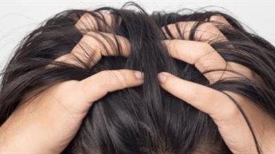 حب الشباب في فروة الرأس.. الأسباب والتشخيص وطرق الوقاية والعلاج - الخليج الان